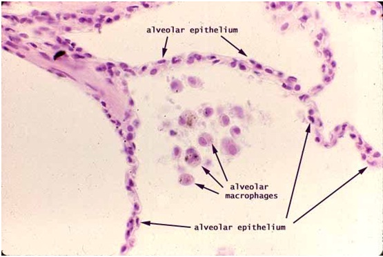 2015_lung tissue.jpg